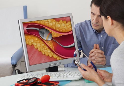 L’insufficienza mitralica secondaria post infarto: come intervenire